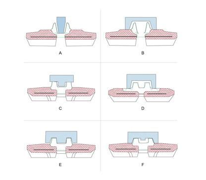 Excavators Rubber Track (400X72.5X70W) for Equipment